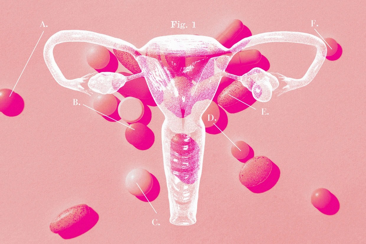 PCOS symptoms are still difficult for doctors to diagnose and treat. Here's why - Vimarsana News