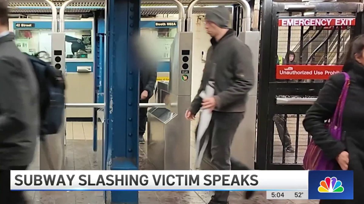 NYC subway slashing victim shares his story of what happened – NBC New York
