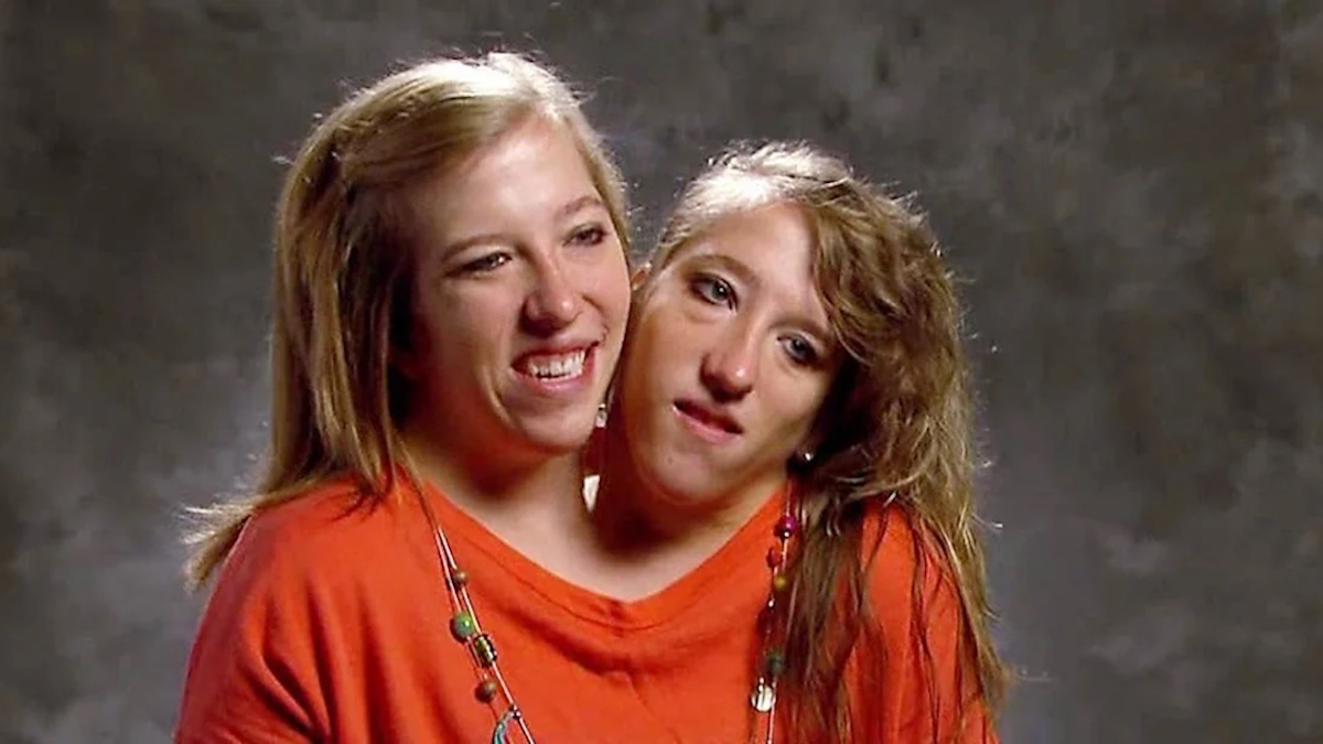 Conjoined twin Abby Hensel is married NBC New York