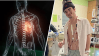 Doctor shares warning signs after Virginia college athlete sidelined by heart condition