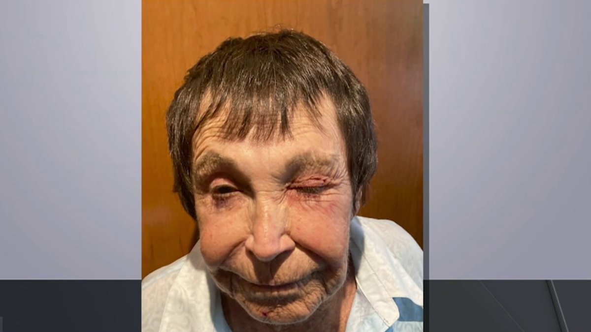 89-year-old comedian gets sucker punched in NYC