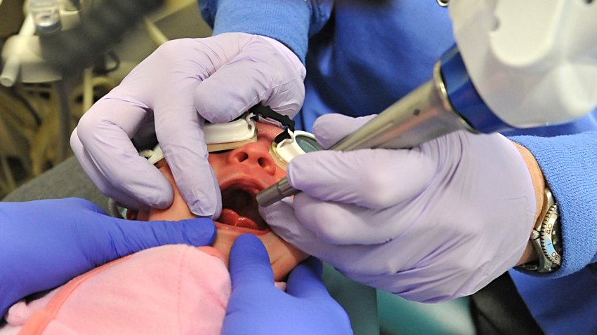 Dr. Lawrence Kotlow demonstrates a tongue tie procedure on baby Brey Shepanski of Rochester on Friday, Jan. 16, 2015 in Albany, N.Y. Kotlow specializes in pediatric dentistry and the diagnosis and treatment of tongue tie, which is done to help babies who cannot breast feed.