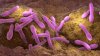 NJ resident tests positive for botulism, health officials say