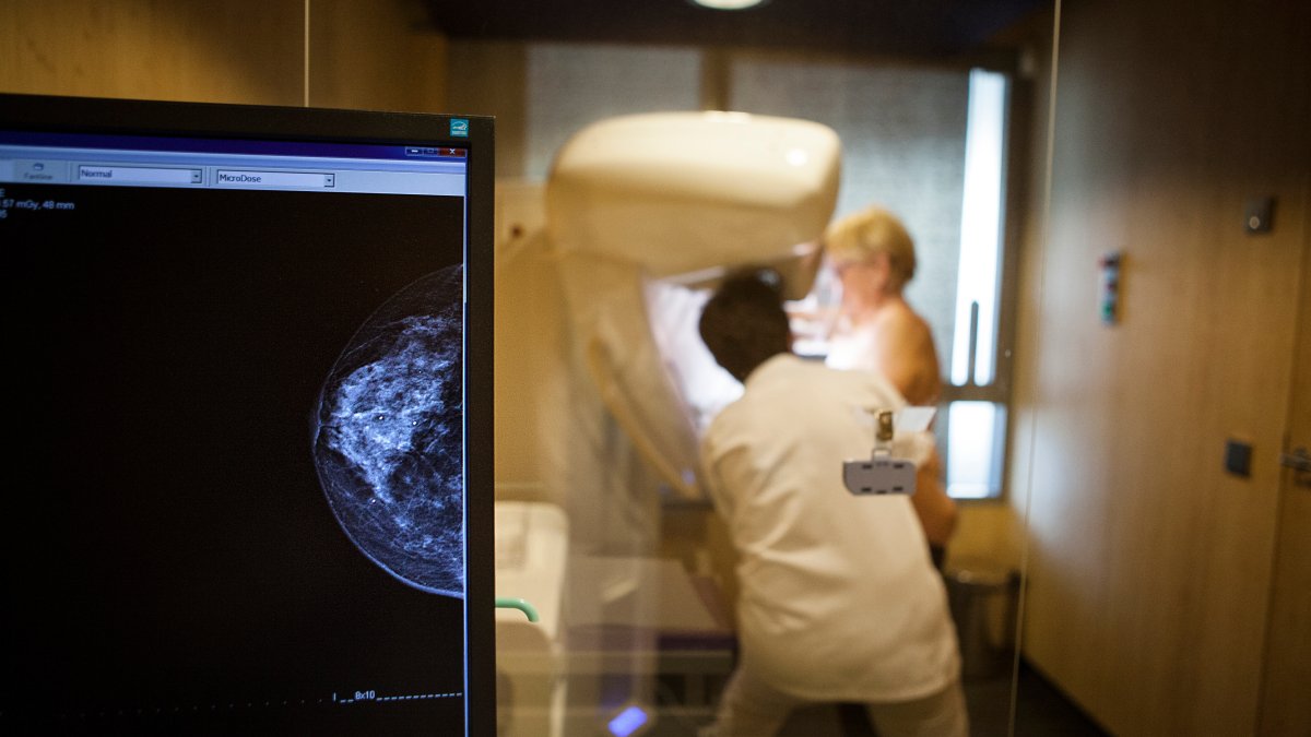 Dense breasts can make it harder to spot cancer on a mammogram – NBC New York