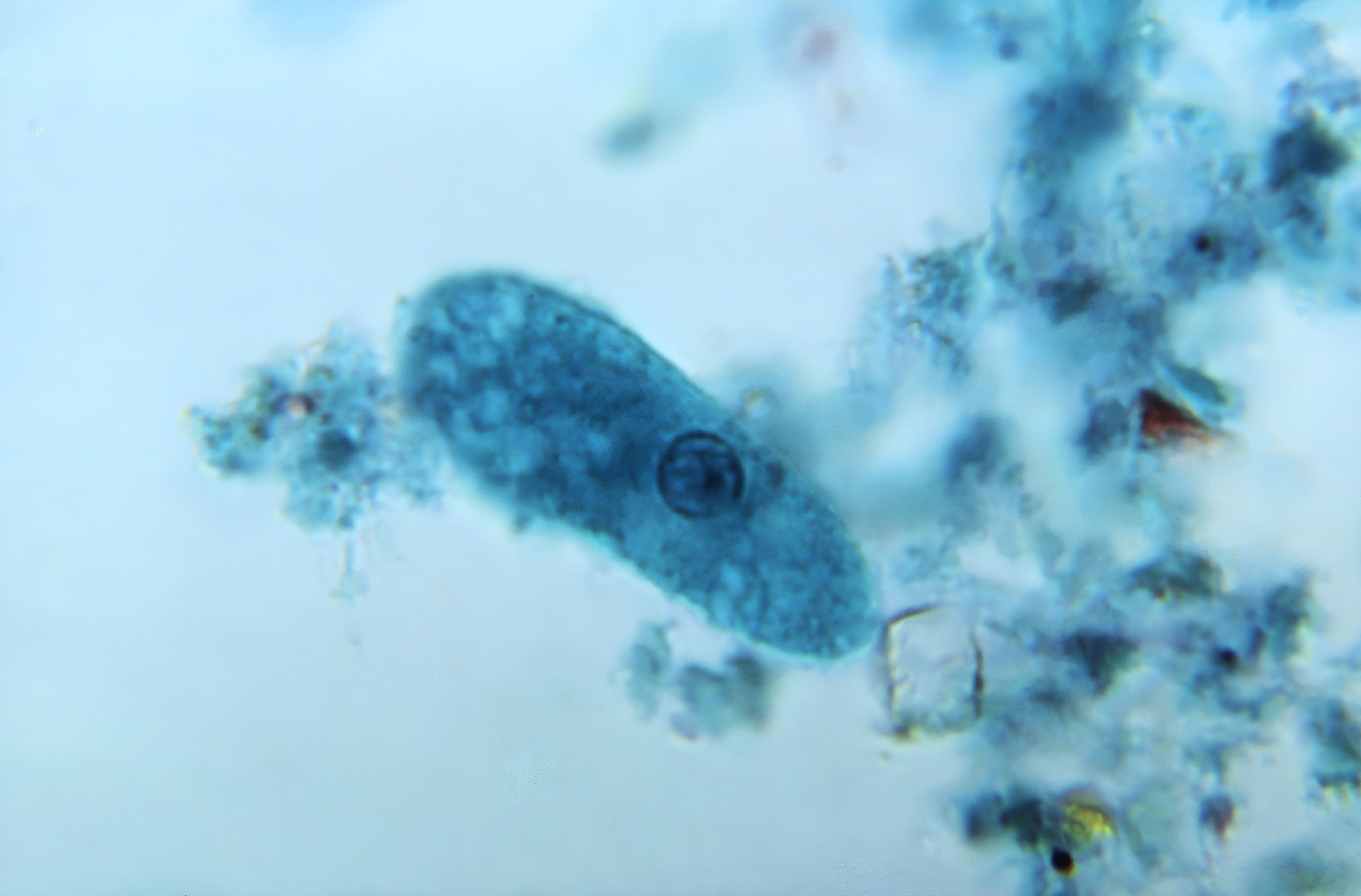 Greater than 160,000 kilos of floor beef recalled nationwide over E. coli considerations Greater than 160,000 kilos of floor beef recalled nationwide over E. coli considerations