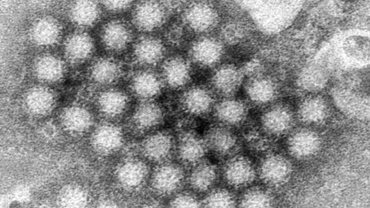 Surge in Norovirus Cases This Winter: What You Need to Know Surge in Norovirus Cases This Winter: What You Need to Know