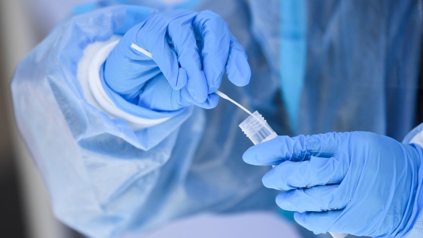 A healthcare worker places a test swab into solution for a PCR Covid-19 test at a Reliant Health Services testing site in Hawthorne, California on January 18, 2022. (Photo by Patrick T. FALLON / AFP) (Photo by PATRICK T. FALLON/AFP via Getty Images)