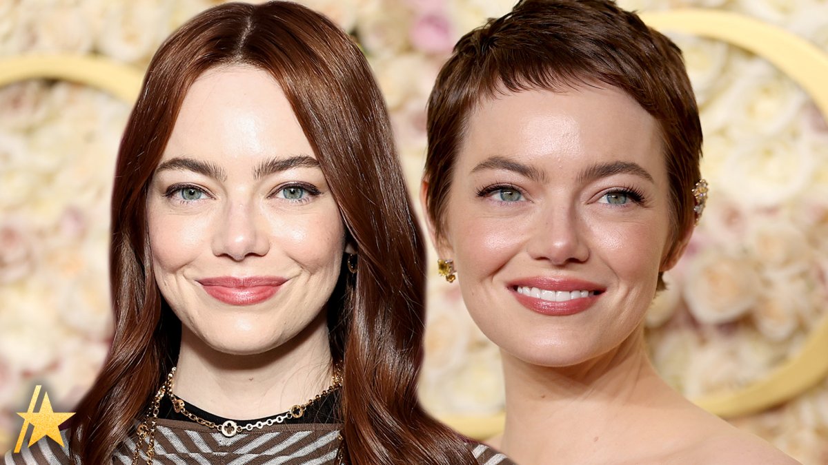 Emma Stone'S Baldness: The Hollywood Star'S Unexpected Confession - xt1i0up