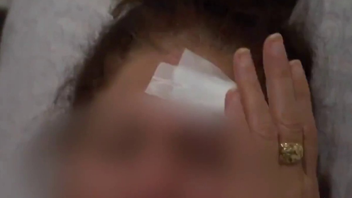 Woman grazed by bullet while inside her own apartment in Bronx – NBC ...