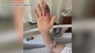 NYC man tried to help a snake along an NJ bike path. He quickly regretted it