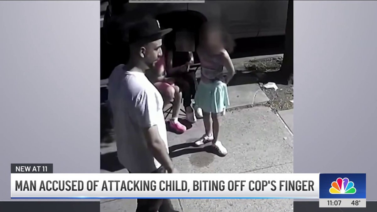 Man accused of attacking child, biting off cop’s finger – NBC New York