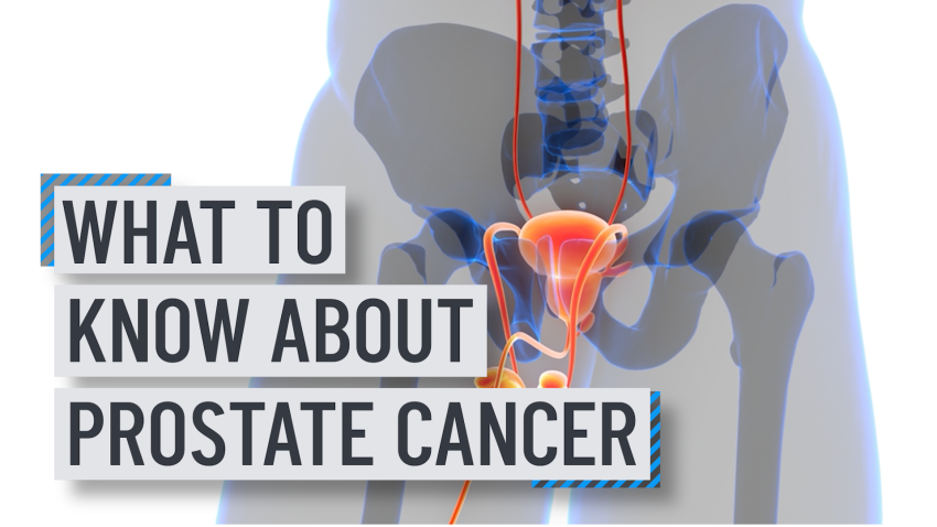 Text reading "what to know about prostate cancer" over an illustration of a man's pelvis and prostate