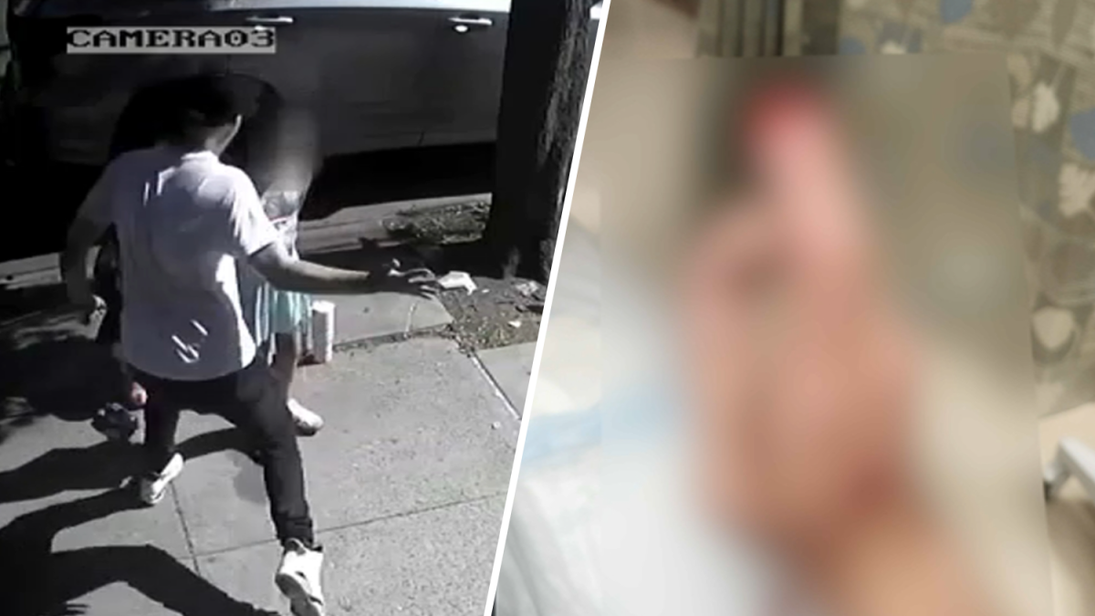Queens man smacks 9-year-old girl across the face, bites officer's fingertip off: DA