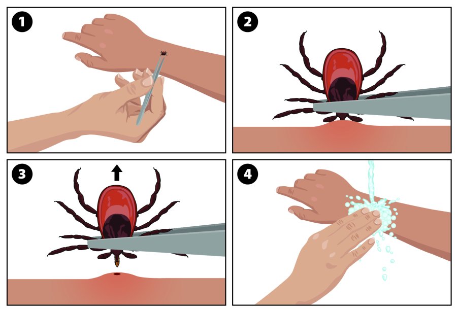 How to keep safe in New York and New Jersey amid a ‘hot tick year'