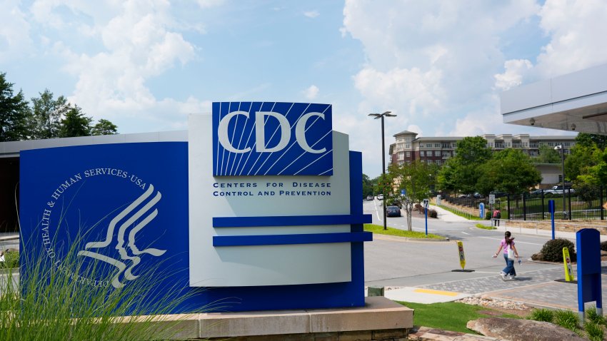 CDC