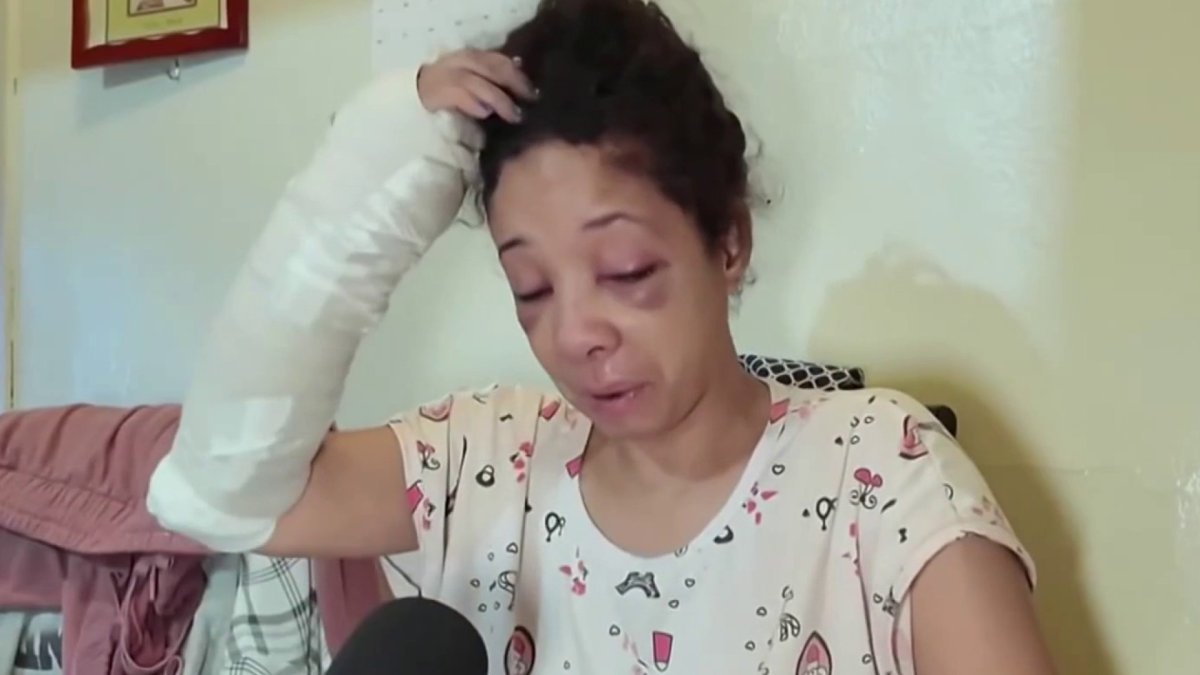 Nurse’s aide attacked by man with pipe in the Bronx, police say – NBC ...