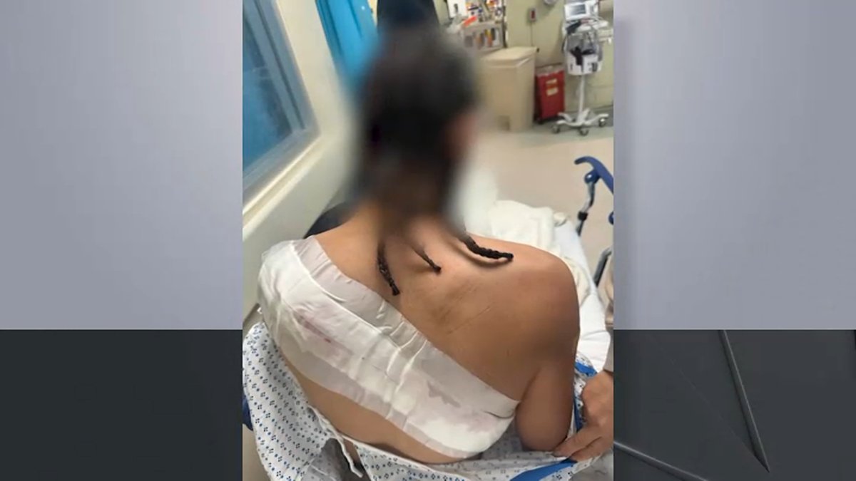 Father speaks after boy, 17, slashed at Bronx high school