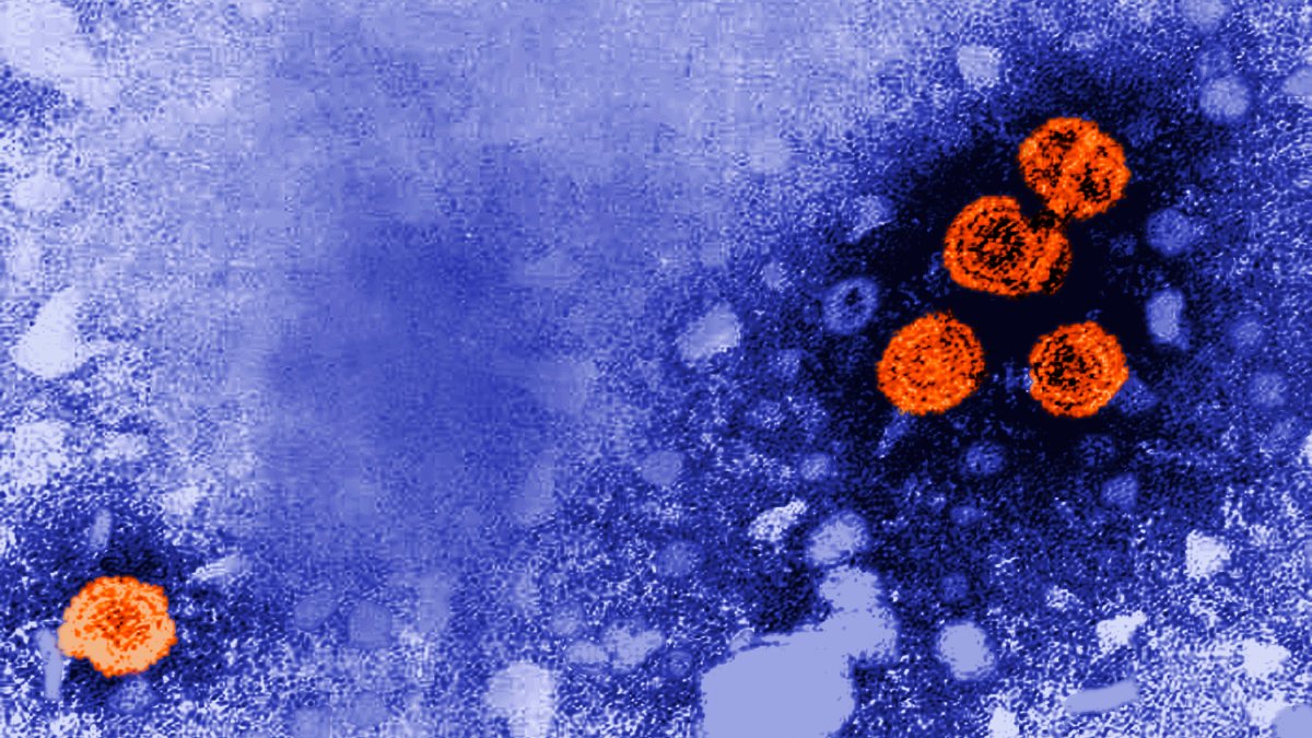 Experimental hepatitis B drug might offer ‘functional cure' for a subset of patients