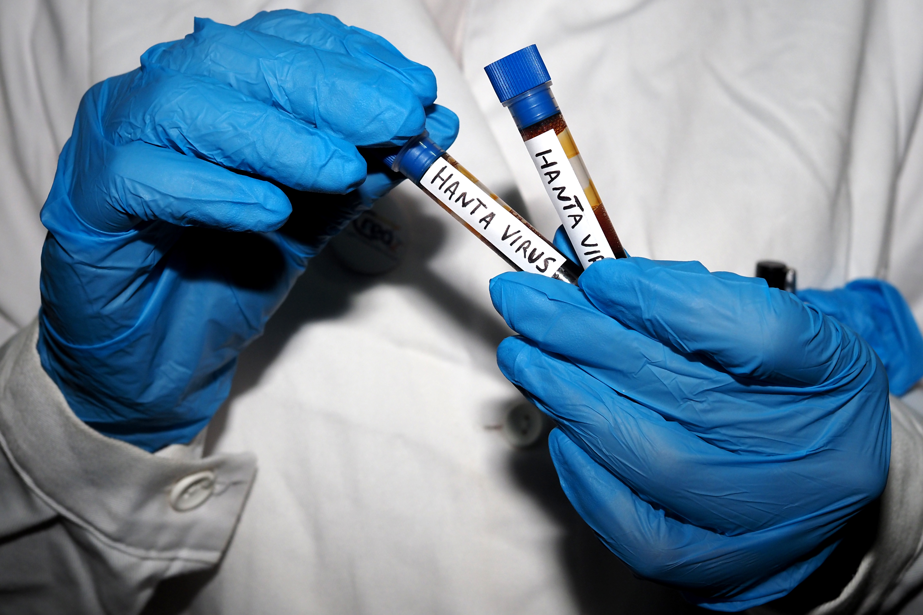 No known cases of hantavirus in U.S. as officials monitor 41 with possible exposure