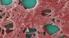 Sixth person dies from Manhattan Legionnaries' disease outbreak