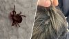 What is rabbit fever? Cases of rare tick-borne illness reported on Long Island