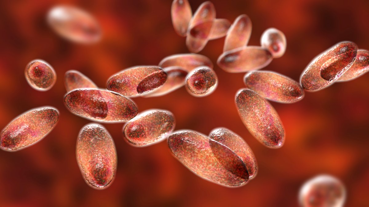 Russian Lab Russian lab worker dies of suspected pneumonic plague – NBC New York