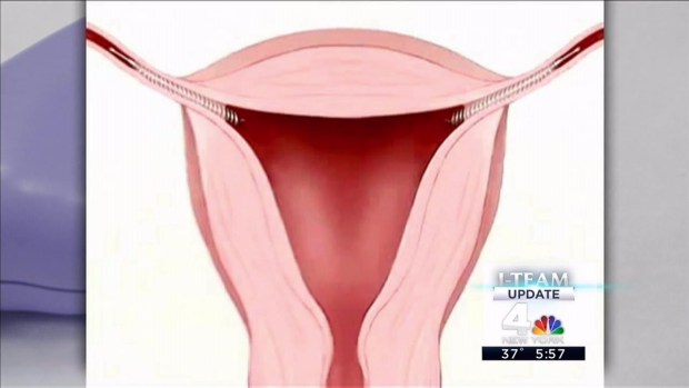 [NY] I-Team Update: New Warnings About Controversial Birth Control Device